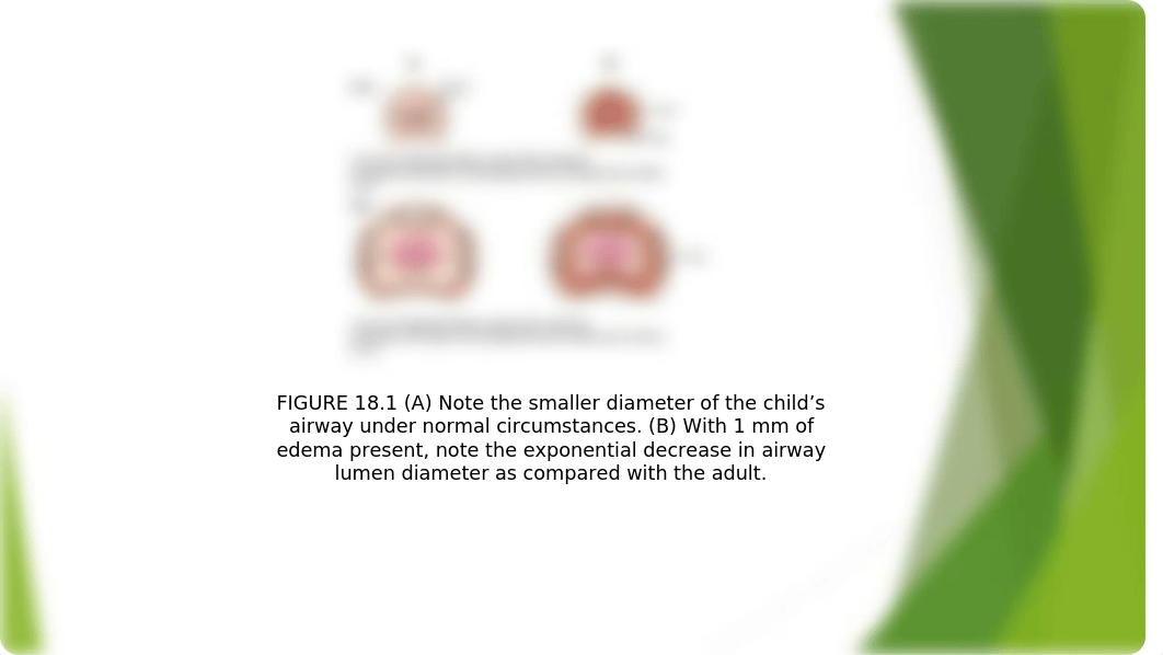 CP Chp. 18 Nursing Care of the Child With an Alteration in Gas Exchange & Respiratory Disorder(1).pp_d03eks858q4_page4