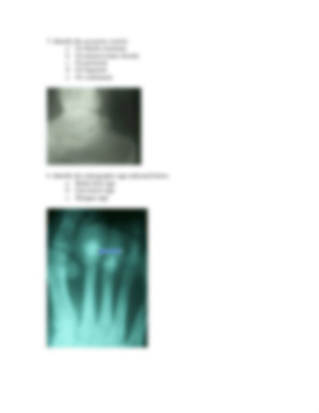 Radiology I Quiz-Interpreting Foot and Ankle Radiographs_d03pcijfek0_page3