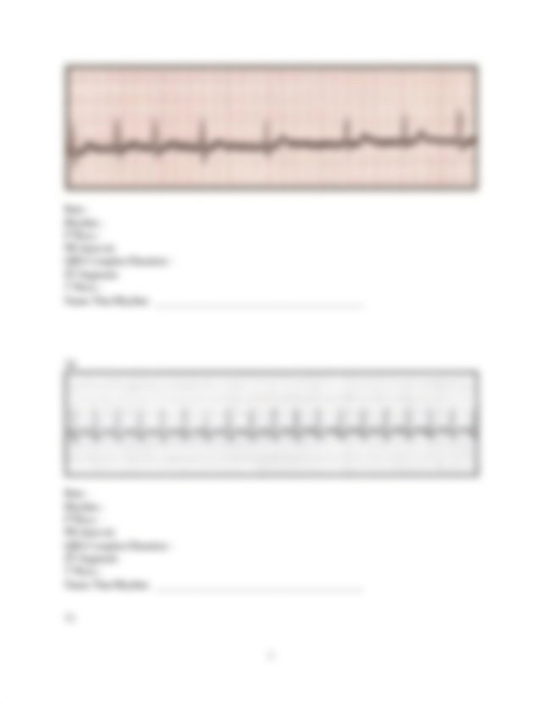 Handout for ECG interpretation.docx_d058lfvgwmc_page5