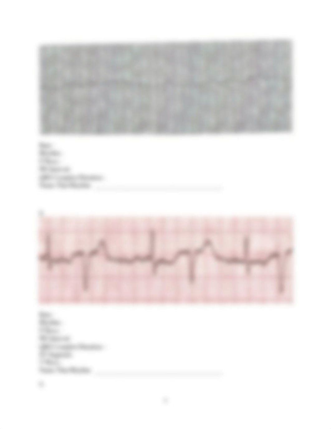 Handout for ECG interpretation.docx_d058lfvgwmc_page4