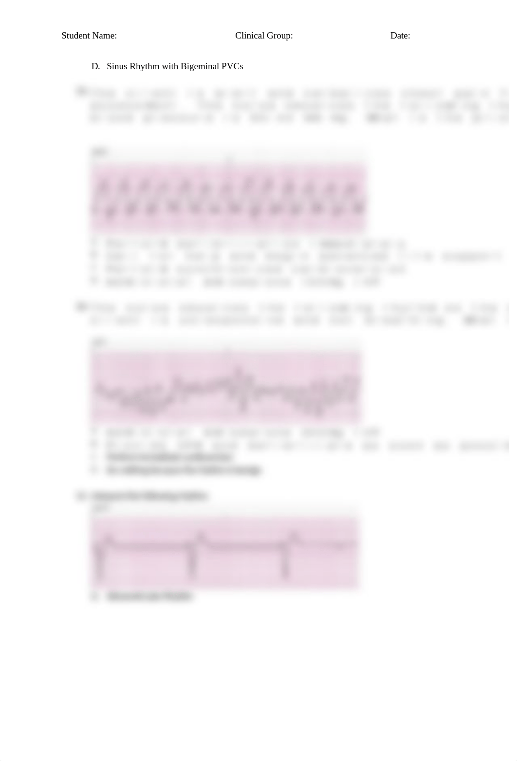 EKG Practice Questions.docx_d07xjnn9io0_page5