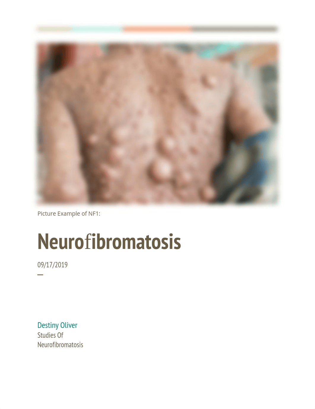 Neurofibromatosis_d09n93da28t_page1