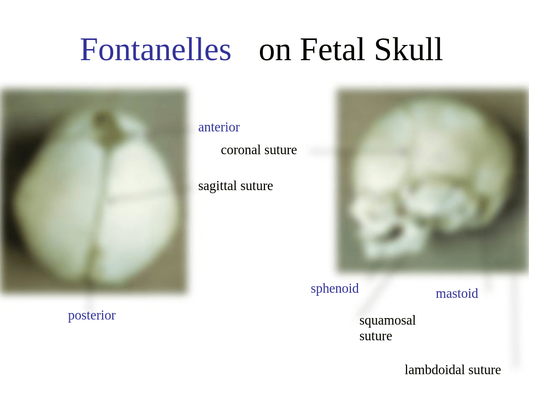 skeleton labeled.ppt_d0cjyqgfsix_page4