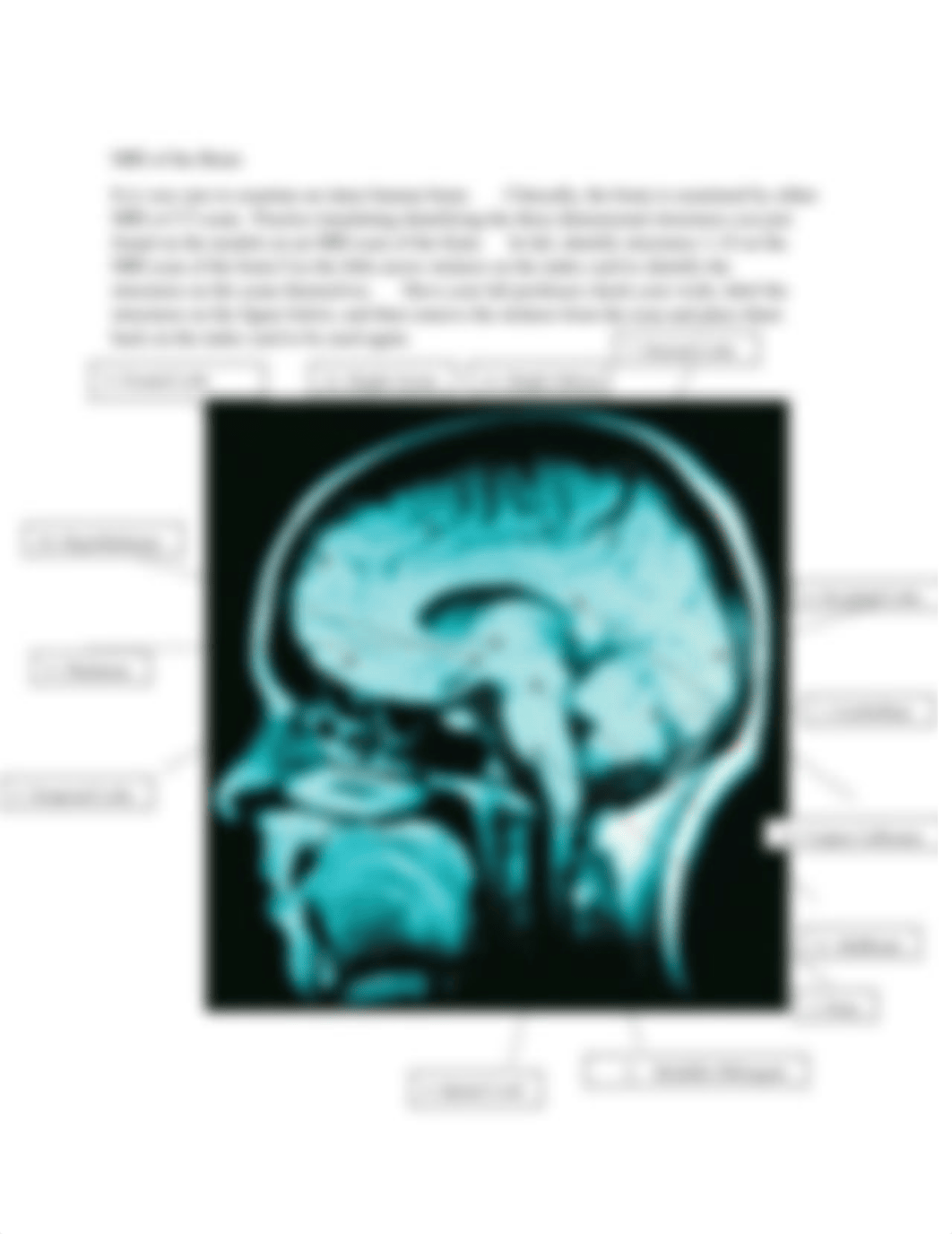 Bio II CNS Anatomy Lab.pdf_d0g9st1fzbk_page3