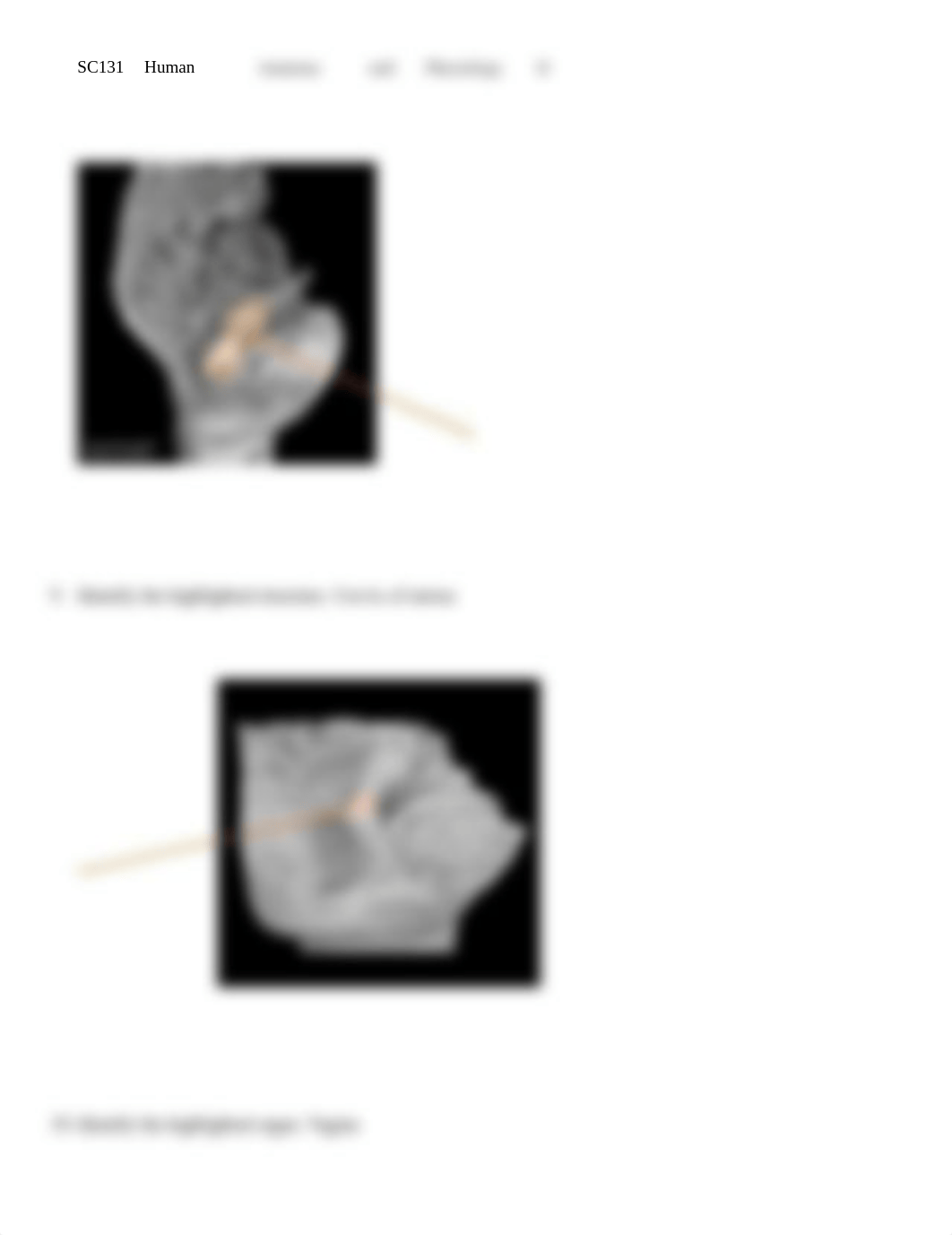 Erin Labrecque Unit 8 Assignment _ Lab Worksheet - Male and Female Reproductive_d0qgi67w056_page5