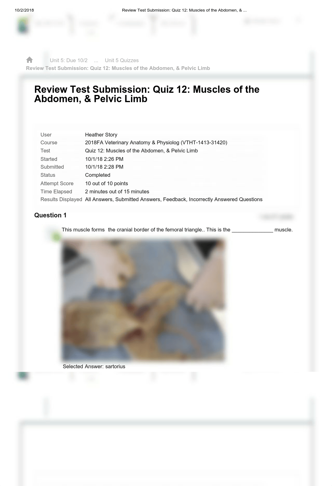 Review Test Submission_ Quiz 12_ Muscles of the Abdomen, & .._.pdf_d0qqwnretul_page1