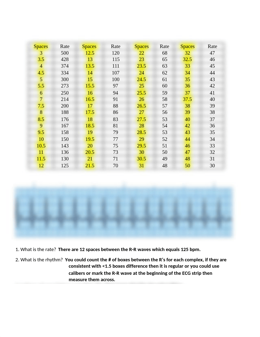 Cardiac Case Study w: answers.docx_d0r7ncwsr1h_page2