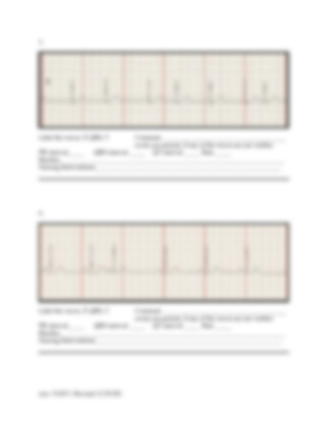 ECG Strip Practice for class.docx_d0sx7kg31a1_page3