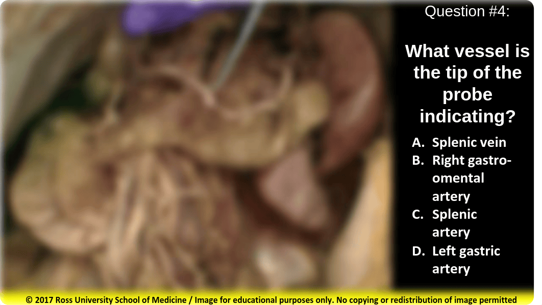 Supracolic and Infracolic Viscera (in-Class Assessment) summer 2018.pdf_d0t4swcj6st_page4