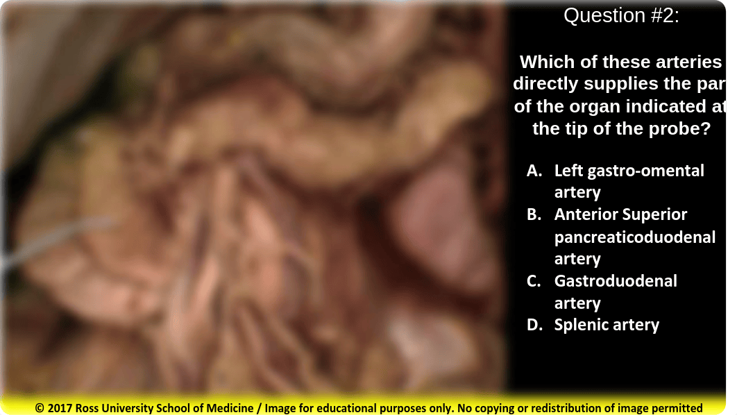 Supracolic and Infracolic Viscera (in-Class Assessment) summer 2018.pdf_d0t4swcj6st_page2