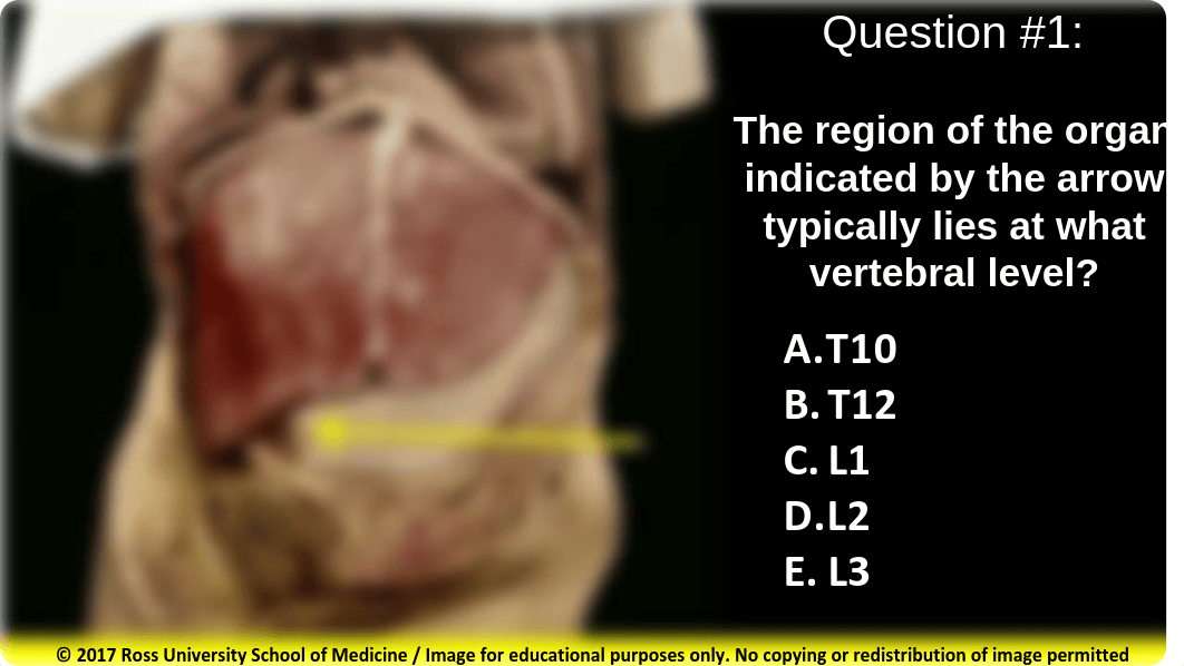 Supracolic and Infracolic Viscera (in-Class Assessment) summer 2018.pdf_d0t4swcj6st_page1