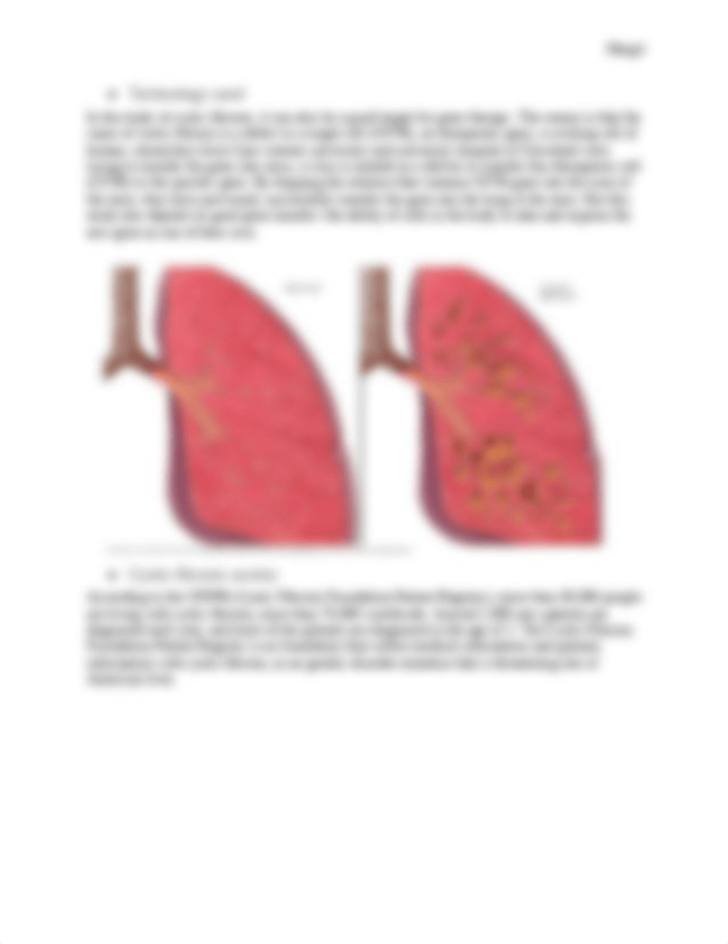 cystic fibrosis disease paper_d0v1kwa978h_page2