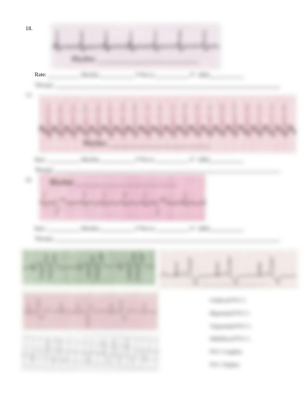 Basic Arrhythmia Recognition .pdf_d0vsf90owtb_page4