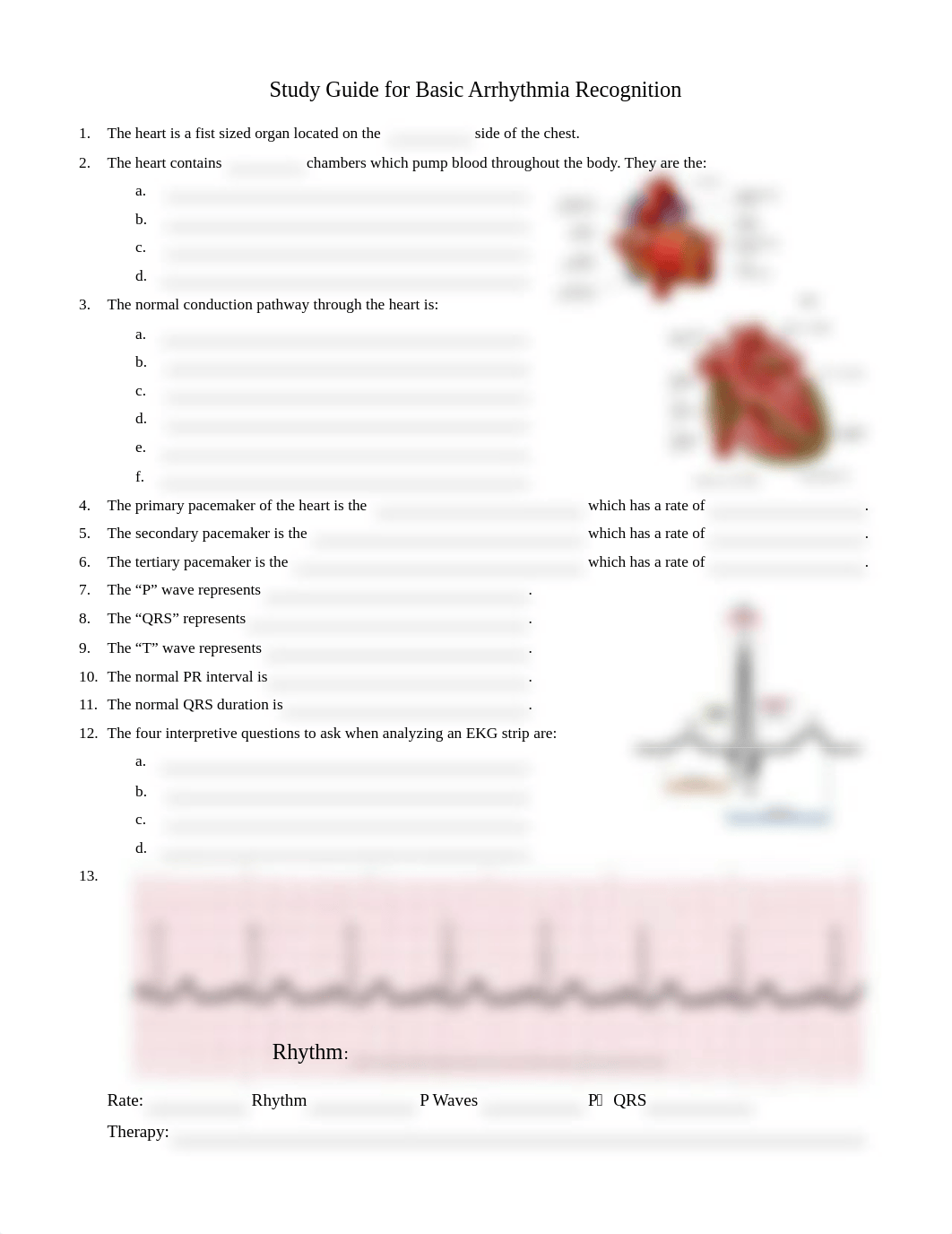 Basic Arrhythmia Recognition .pdf_d0vsf90owtb_page2