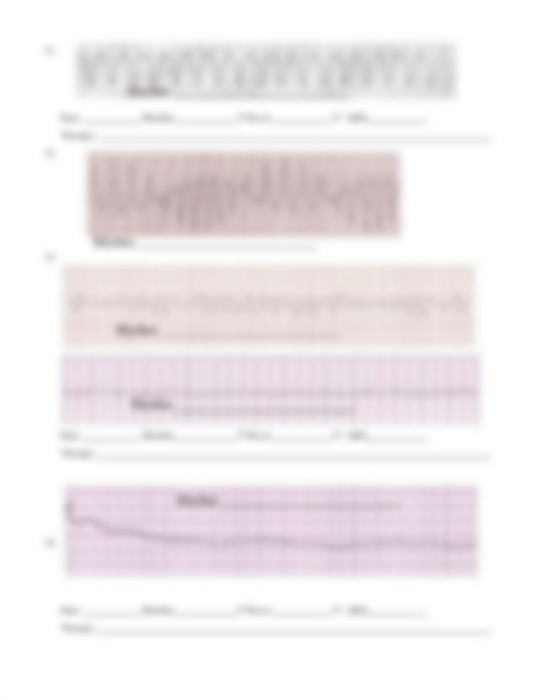 Basic Arrhythmia Recognition .pdf_d0vsf90owtb_page5