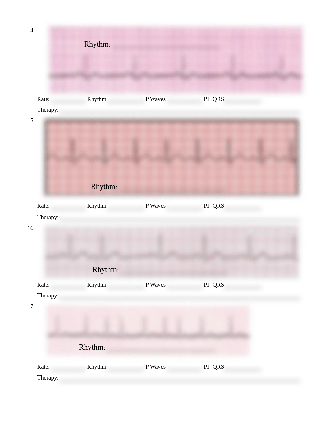 Basic Arrhythmia Recognition .pdf_d0vsf90owtb_page3