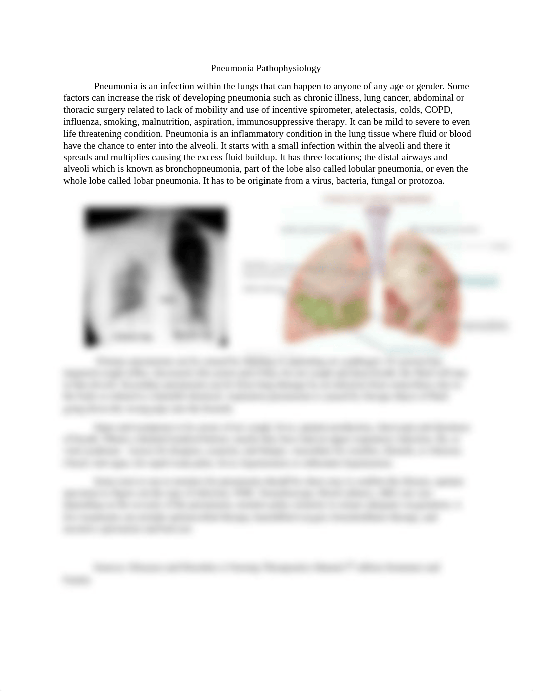 Patho pneumonia.docx_d0yqwwk4xkb_page1