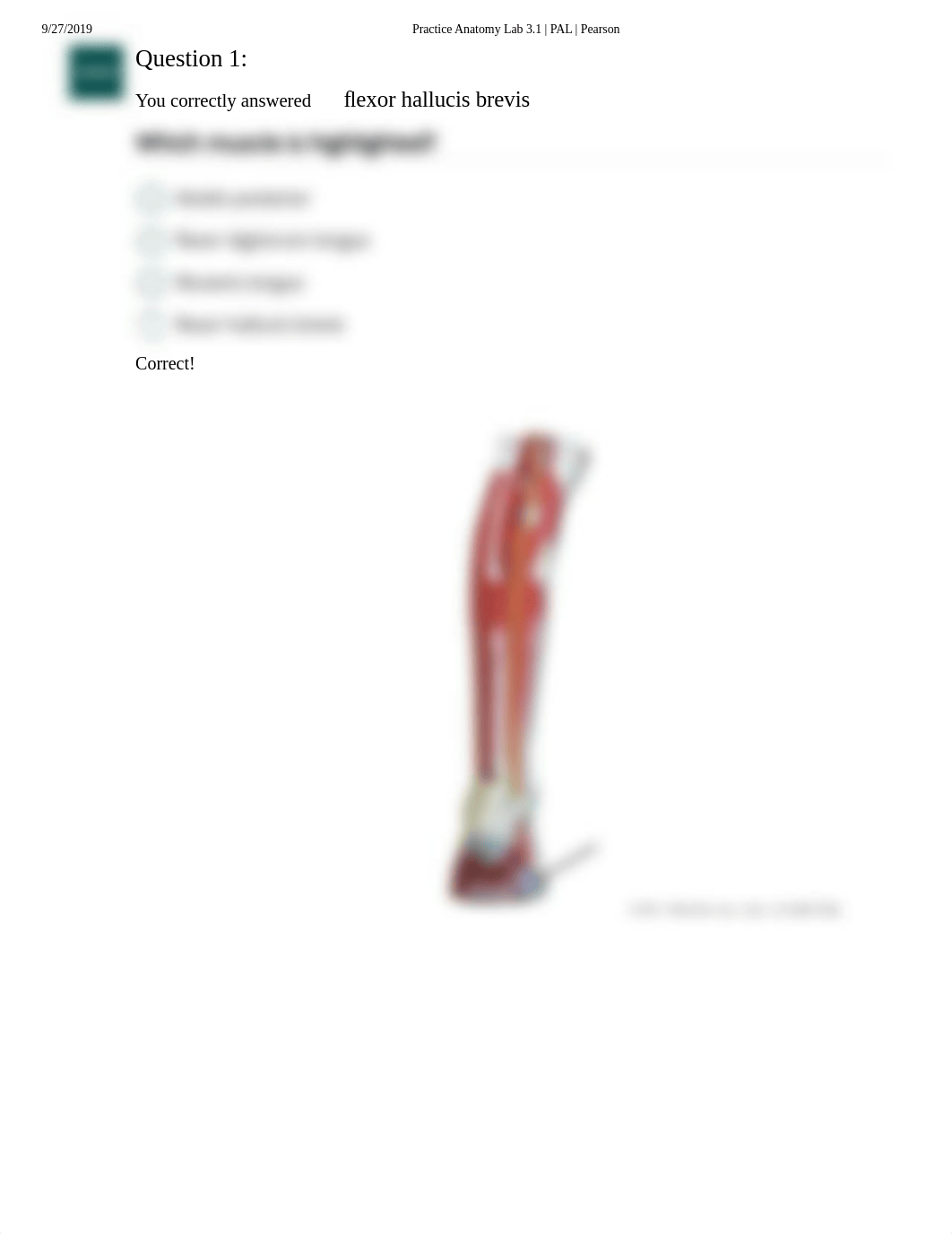 Pal Quiz Lower Limbs anatomical models .pdf_d10amm03qid_page2