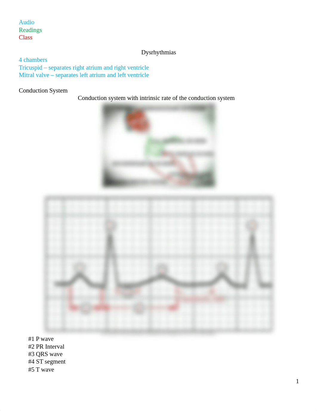 Dysrhythmias Lecture Guide_d116b0x4vsq_page1