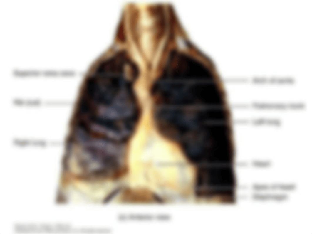 Ch. 14 The Cardiovascular System - Heart_d119rr40hu8_page5