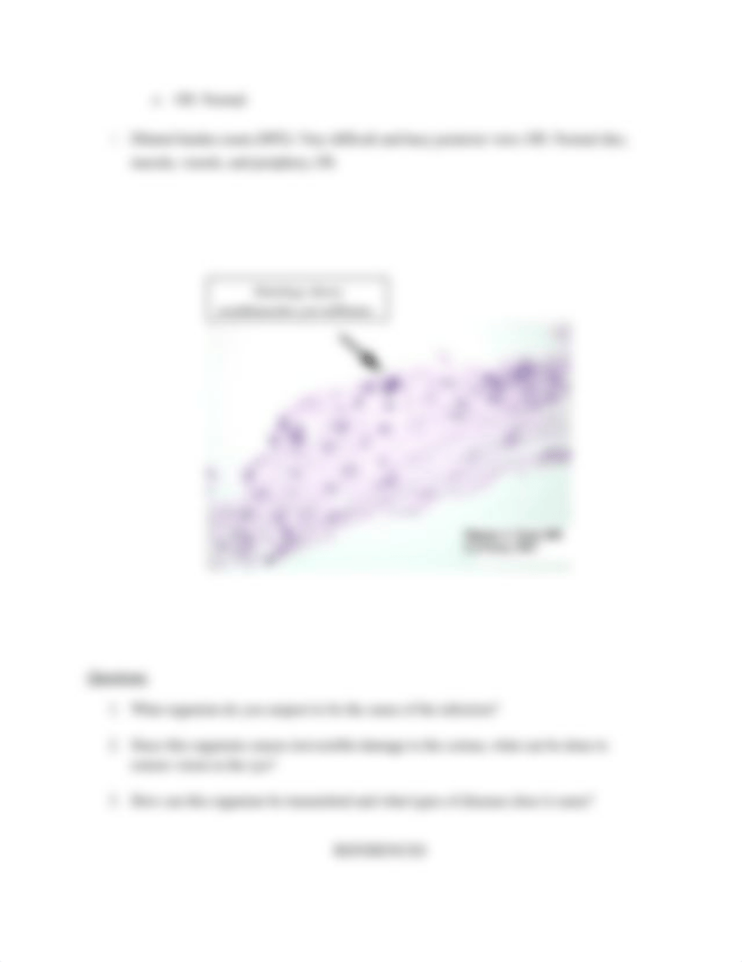 Case Study Acanthamoeba Kerititis.docx_d13nffd4us1_page2