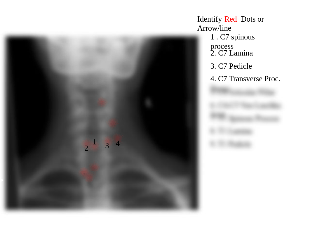 RADD 1611 A-P Lower cervical_d18ji0fqq4x_page2