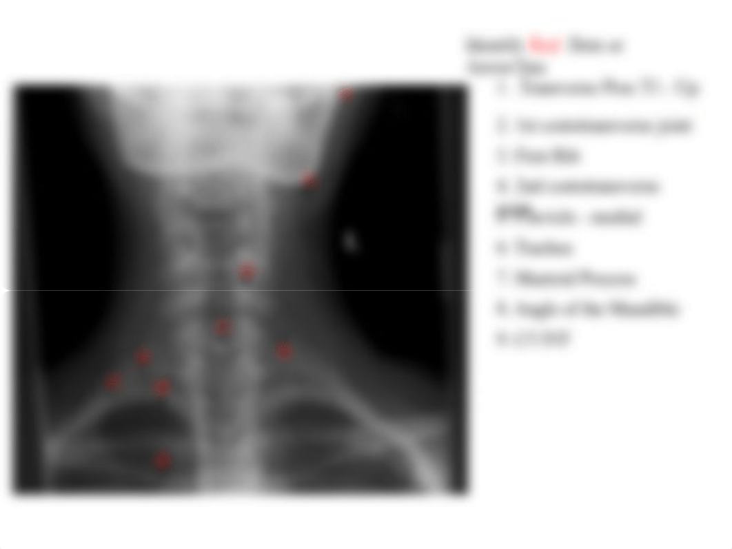 RADD 1611 A-P Lower cervical_d18ji0fqq4x_page3