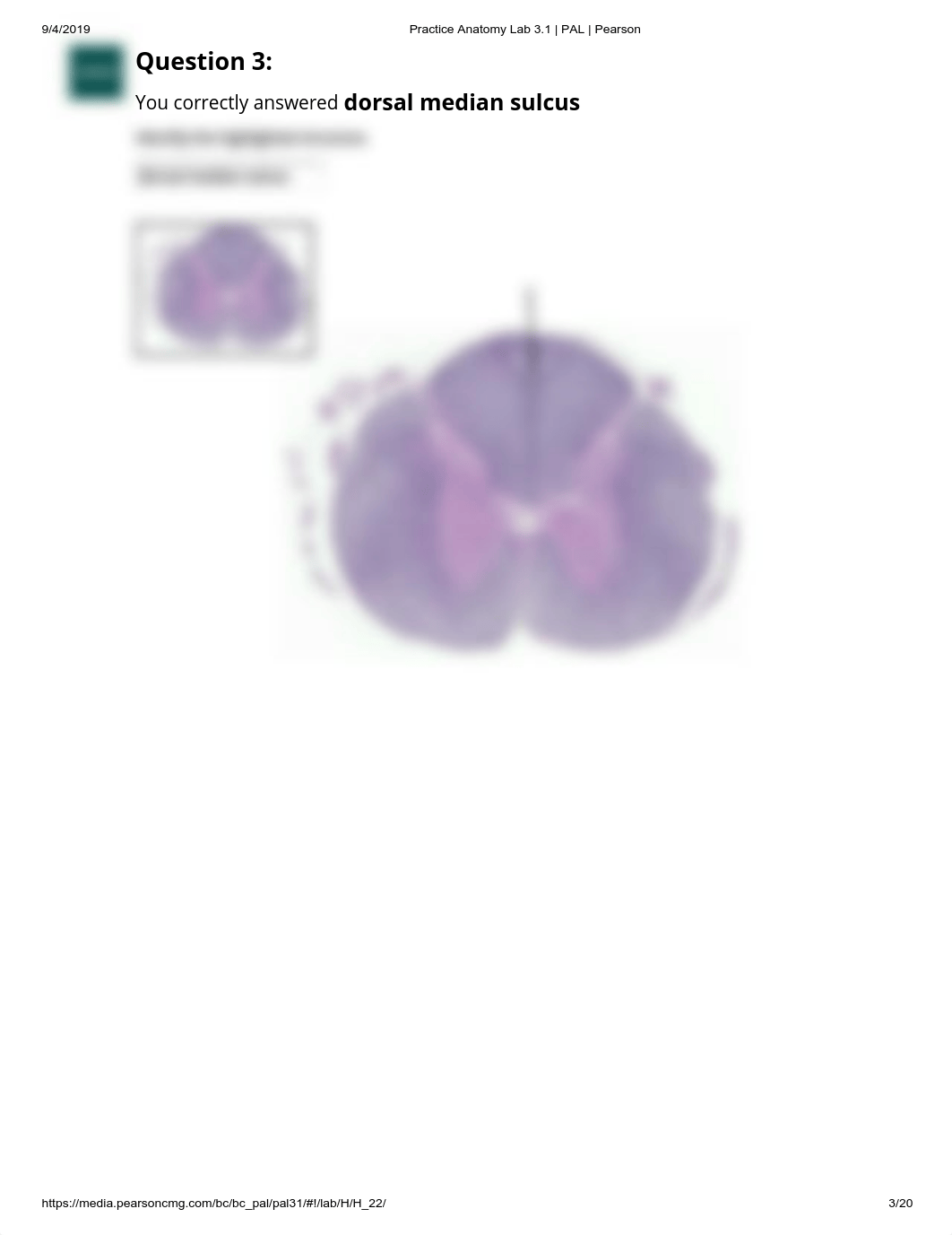 Practice Anatomy Lab 3.1 _ PAL _ Pearson lab practical nervous tissue.pdf_d1awfxudz3l_page3