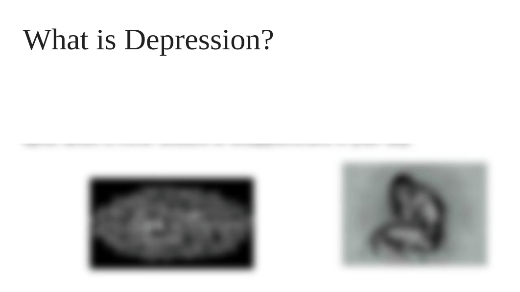 Psychology-depression and the brain.pptx_d1d9few8t5j_page2