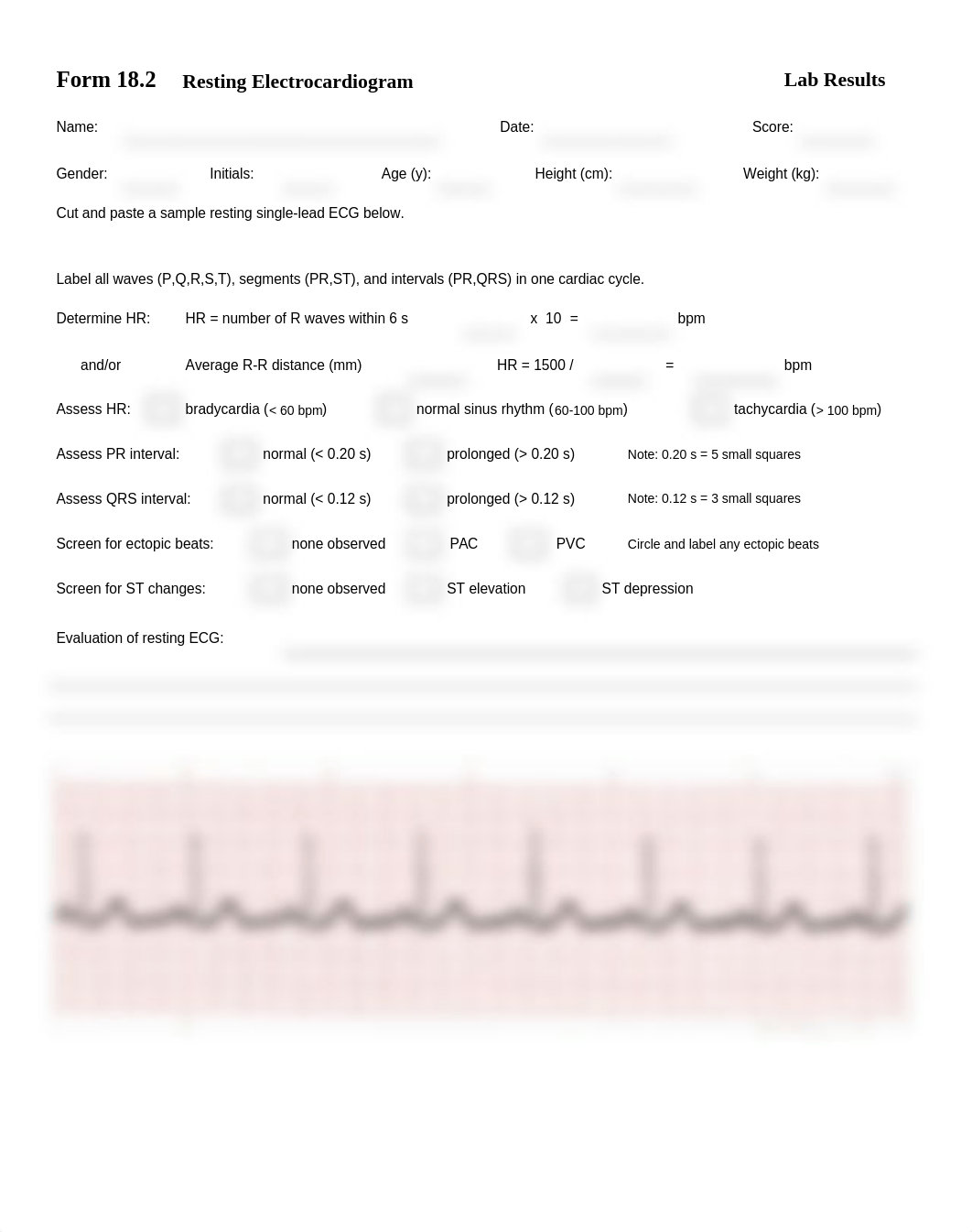 Lab 18.2 $ 18.1 EKG.docx_d1mvqabfq67_page1