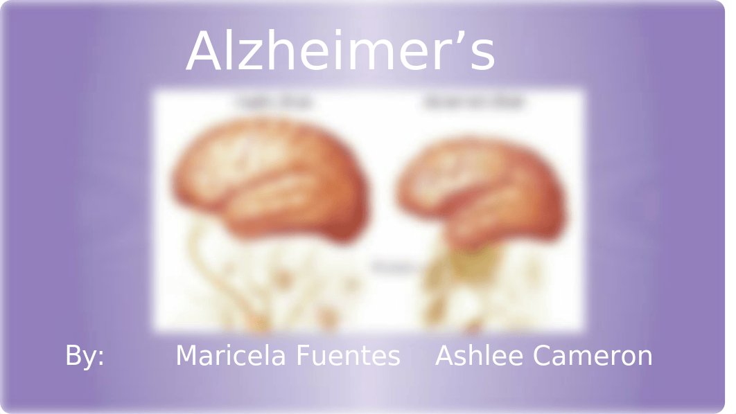 Alzheimer's Presentation Bio18.pptx_d1t1zvc4x4d_page1