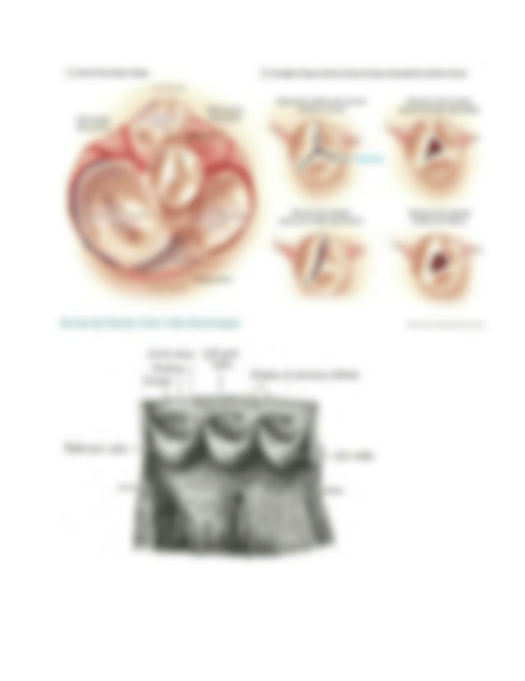 Aortic_Stenosis_images.docx_d1x07gp9tj7_page2