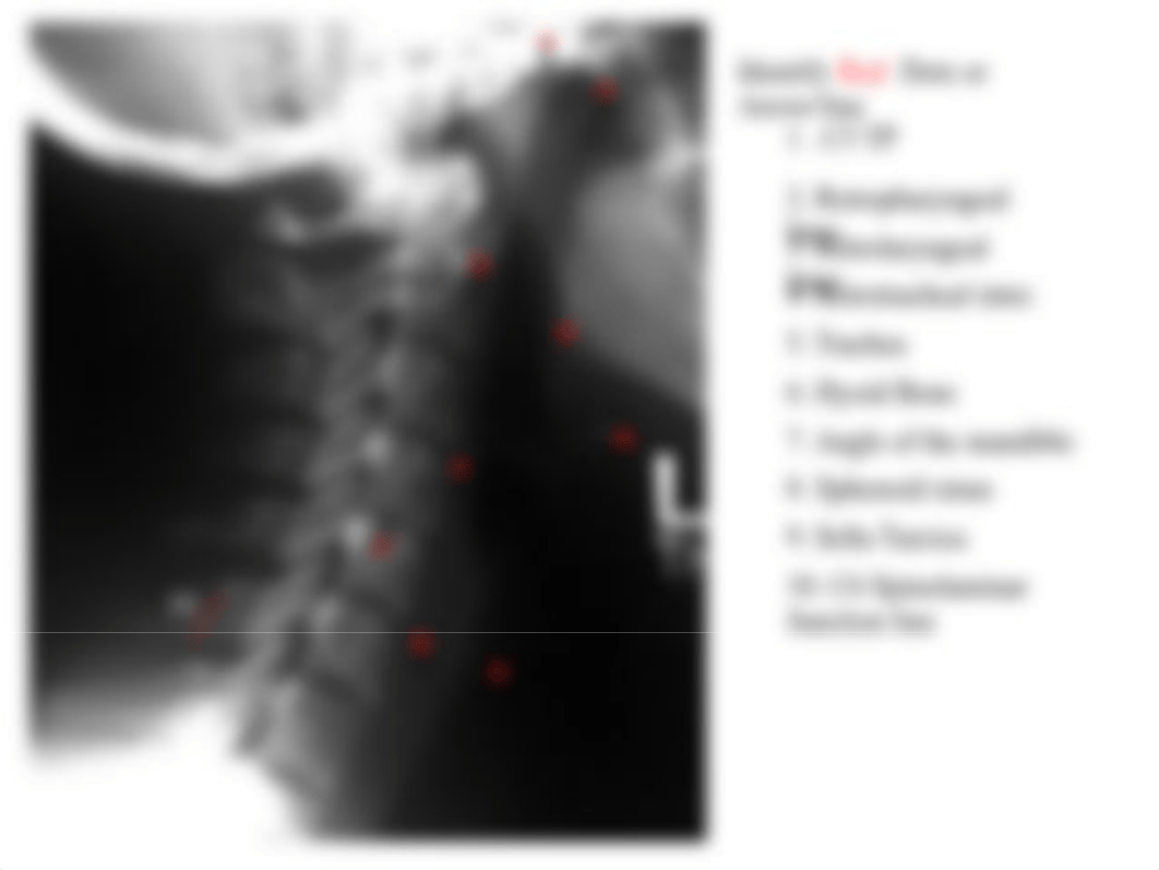 RADD 1611 Lateral Cervical_d25afzi3872_page4