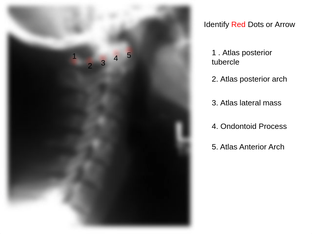 RADD 1611 Lateral Cervical_d25afzi3872_page2