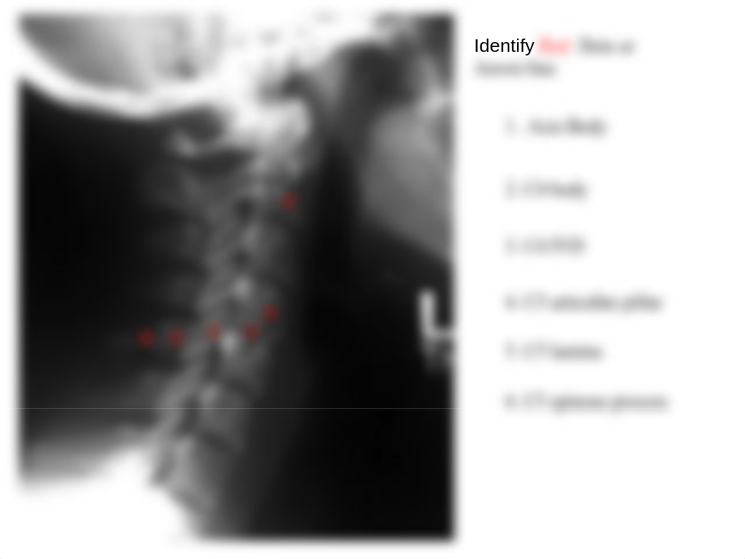 RADD 1611 Lateral Cervical_d25afzi3872_page3