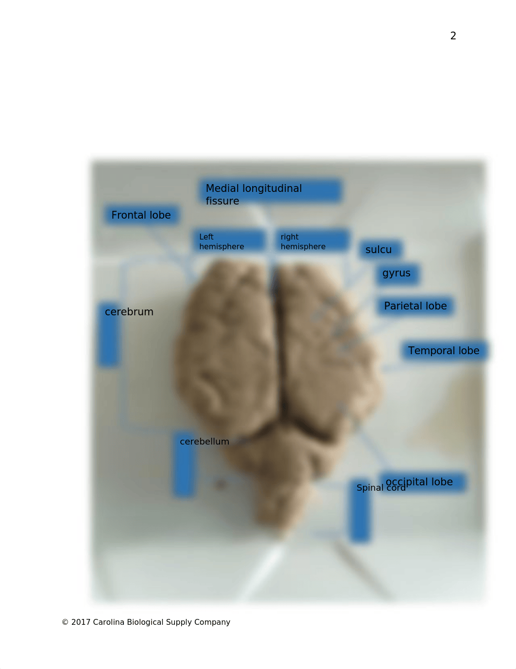 580179 Mammalian Brain Dissection Q.docx_d2bs9u022gi_page3