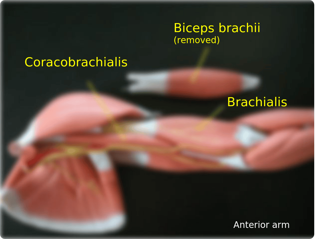 Bio 201 Lab 8 Appendicular Muscles.pptx_d2duk58apjl_page4