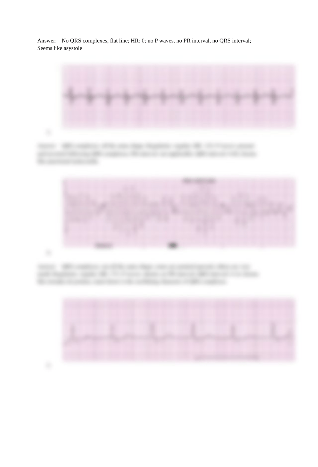 12.2 EKG Interpretation.pdf_d2hbmihoffr_page2