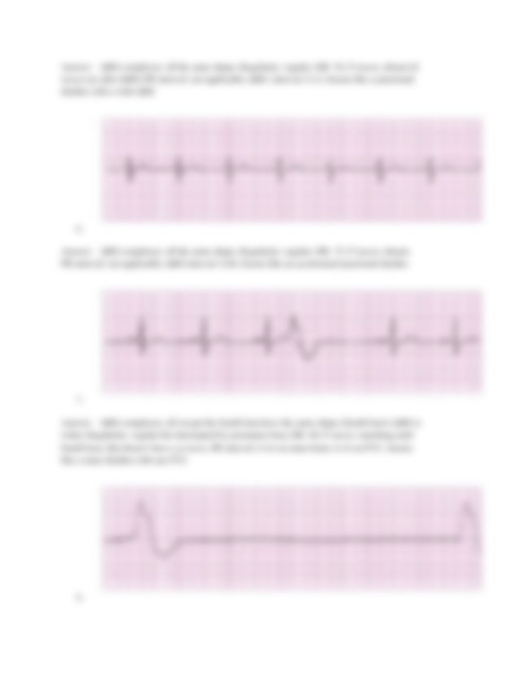 12.2 EKG Interpretation.pdf_d2hbmihoffr_page3