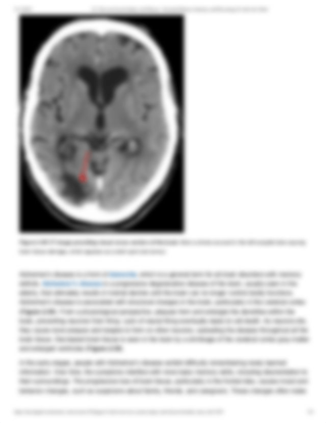 2.6_ Nervous System Injury and Disease _ Essential Human Anatomy and Physiology II with Lab- Burtt.p_d2hvljzwt3y_page3