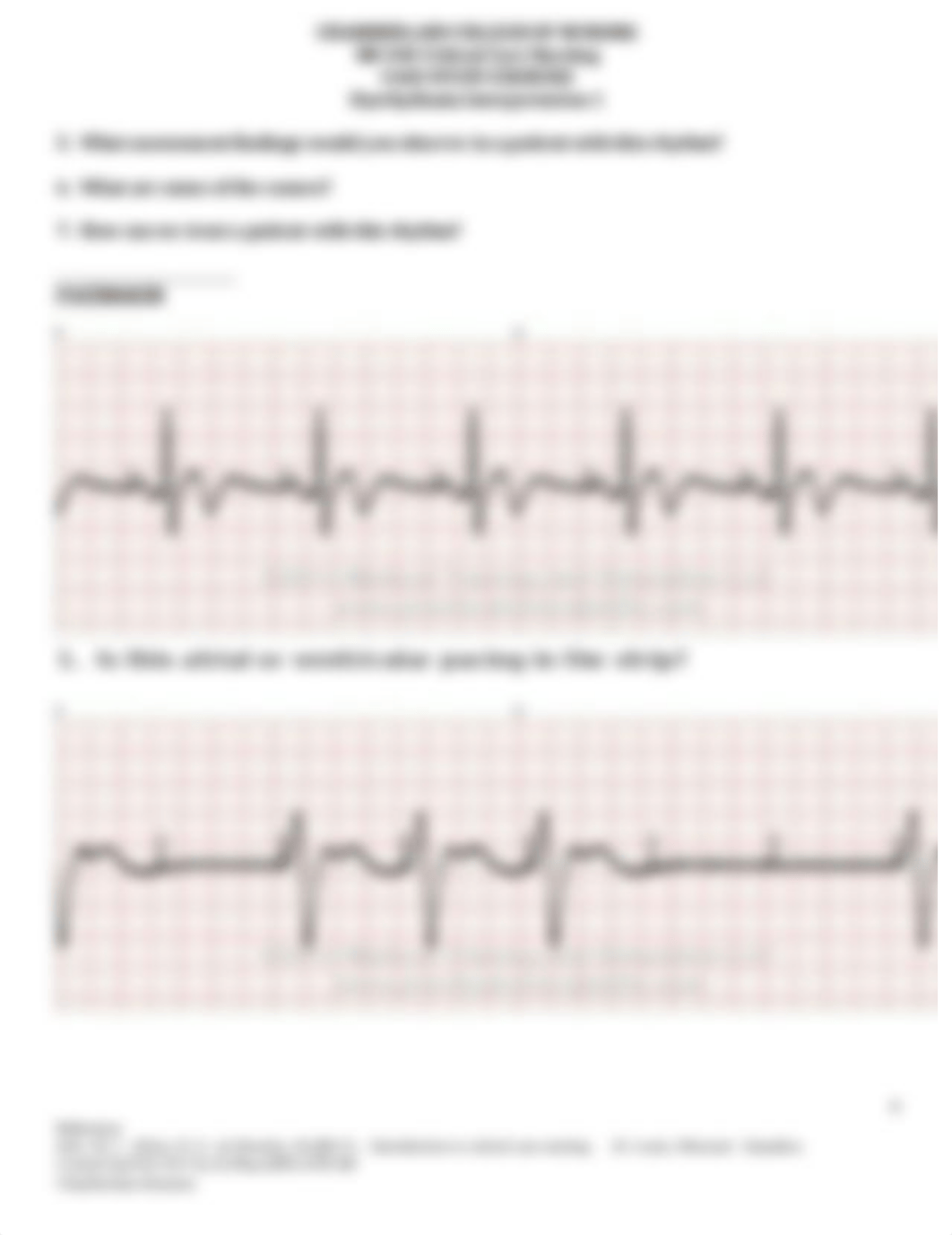 Case study - Dysrhythmia IV2.docx_d2iklnue9za_page4