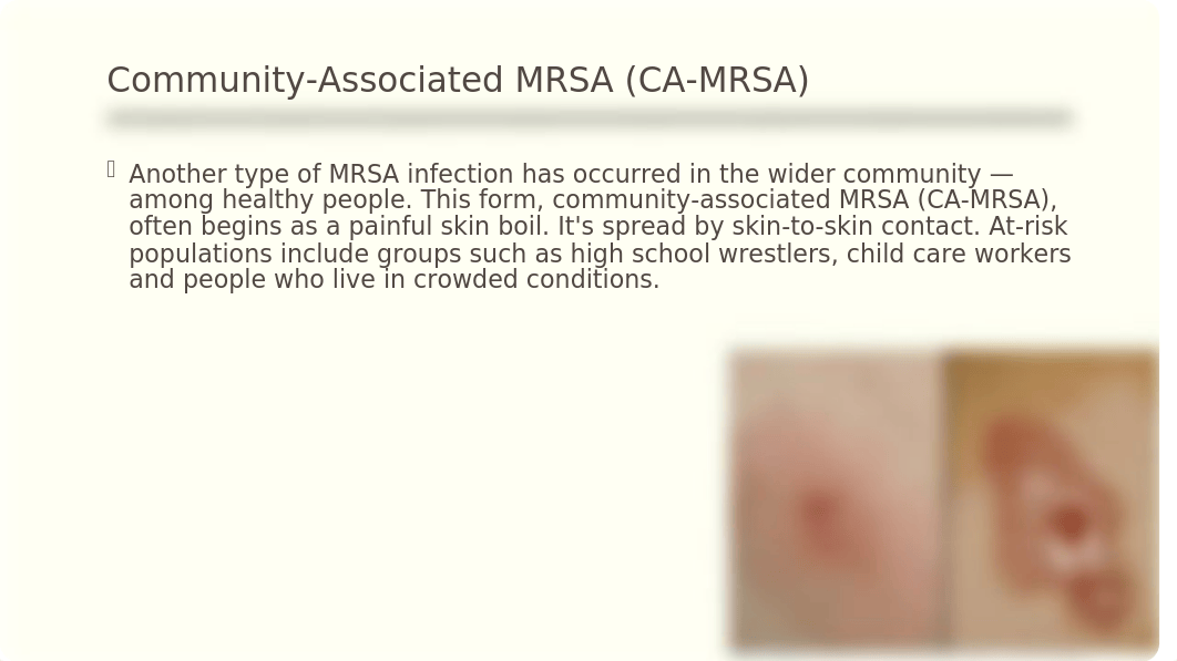 MRSA .pptm_d2jrw3mki37_page3