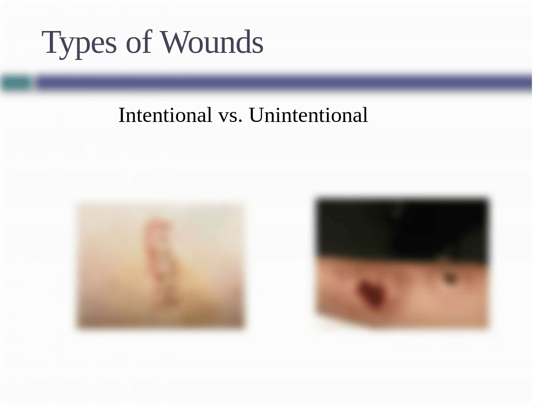 Skin integrity & wound care lecture 8.21.17 Study guide.pptx_d2jz2kobzoc_page4