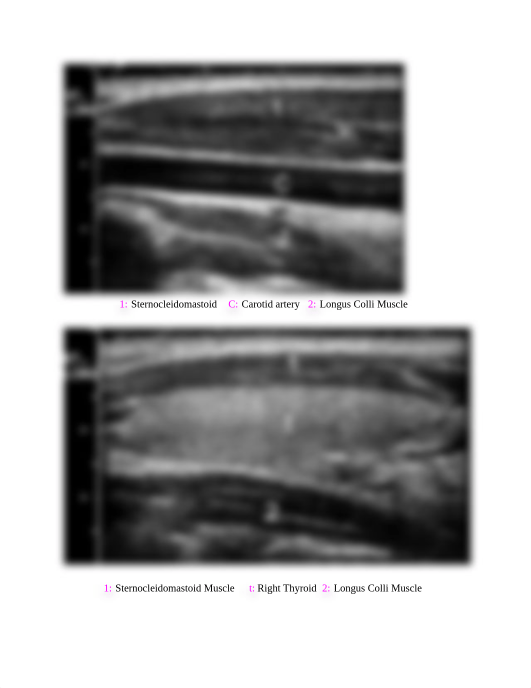 Small Parts 1 Final Review.pdf_d2k33s2rcg5_page2