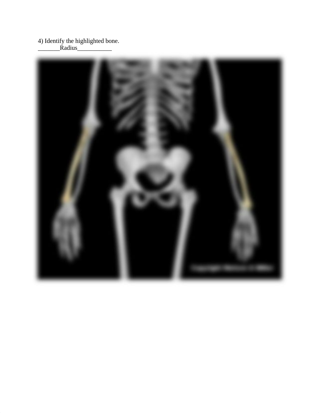 12_upper_limb_skeletal_anatomy_Worksheet.docx_d2ktb8ub5gv_page4