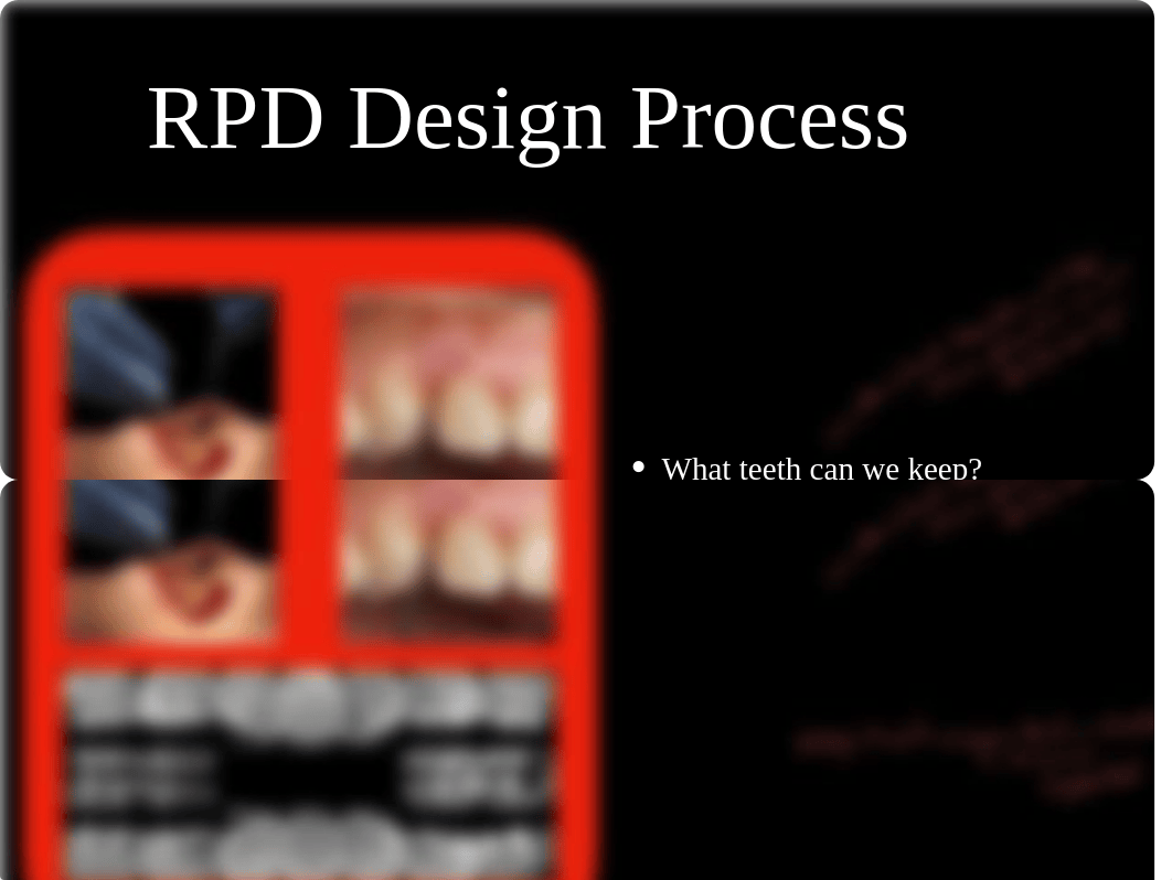 08 - RPD Design Sequence.pdf_d2lggejl7ew_page5