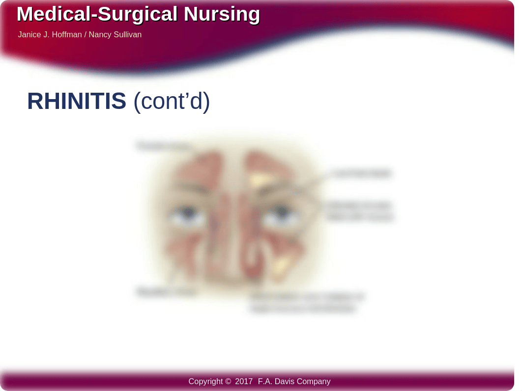 Upper Airway Disorders.pptx_d2nwpkk80q4_page3