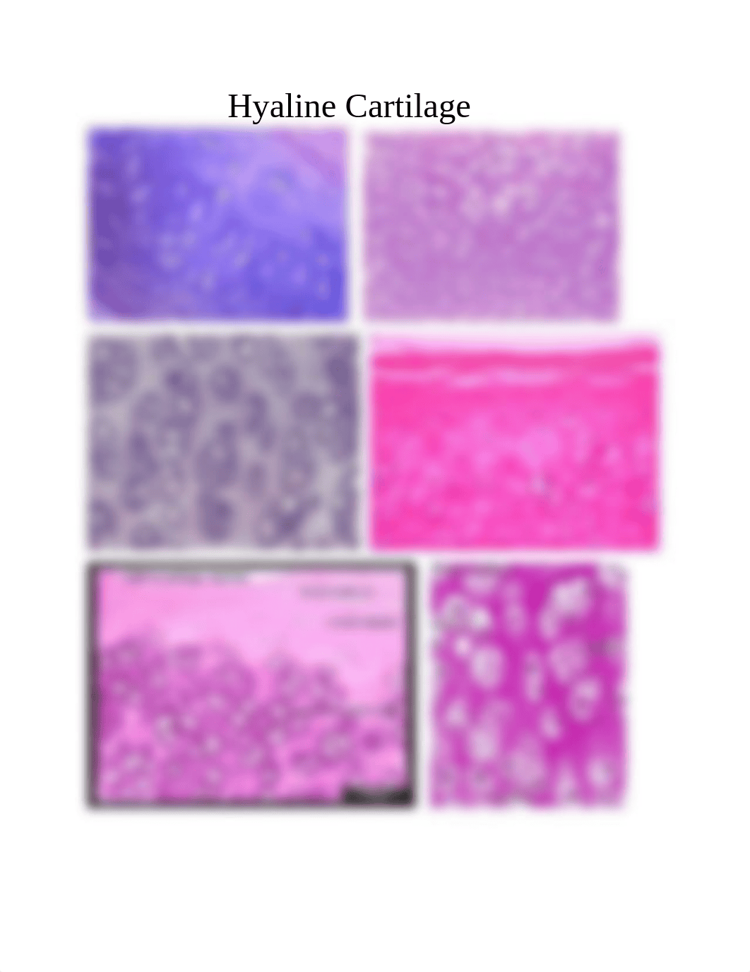 Hyaline Cartilage_d2o04lr1zck_page1