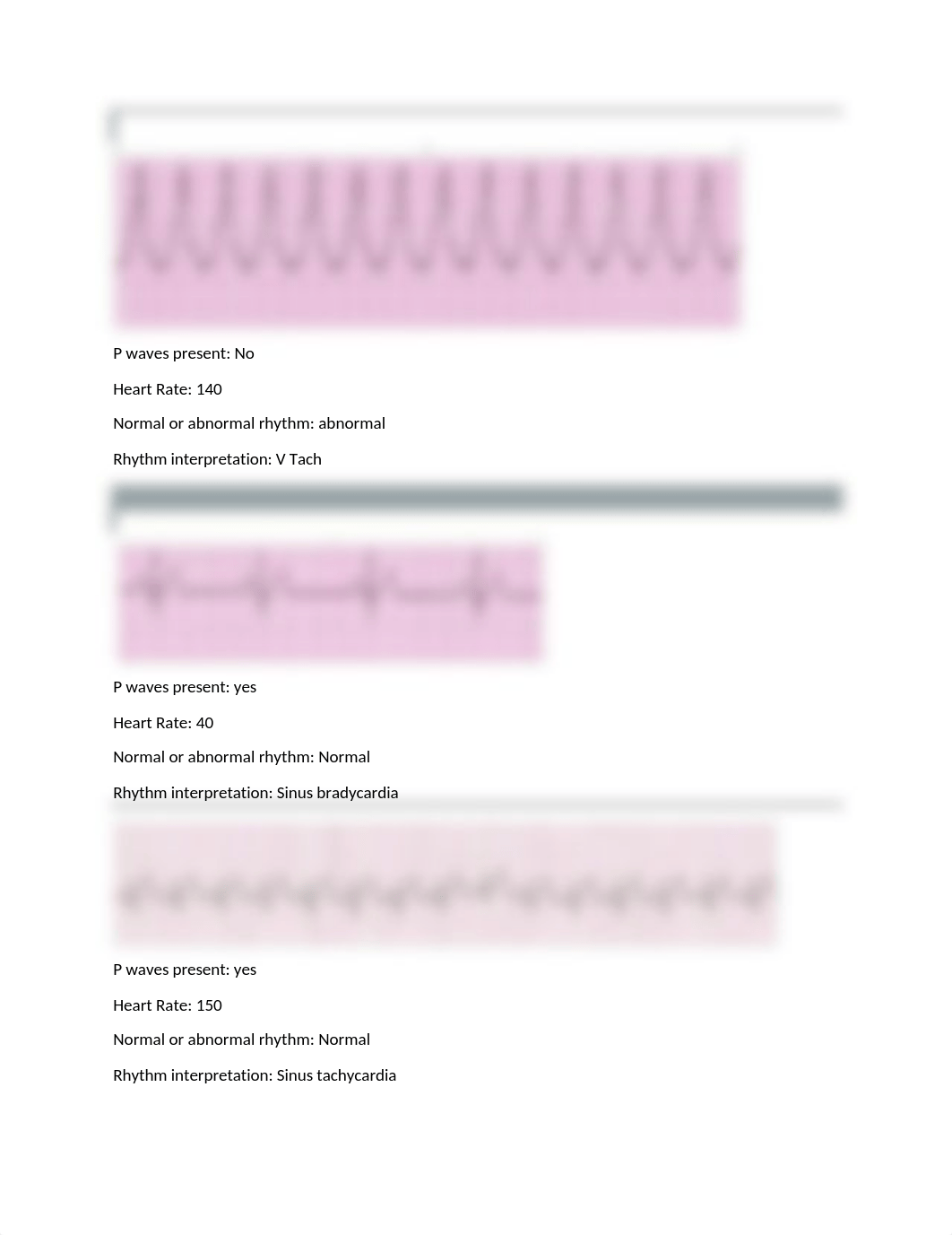 EKG Packet 2021 Milosevich.docx_d2onl212ee6_page1