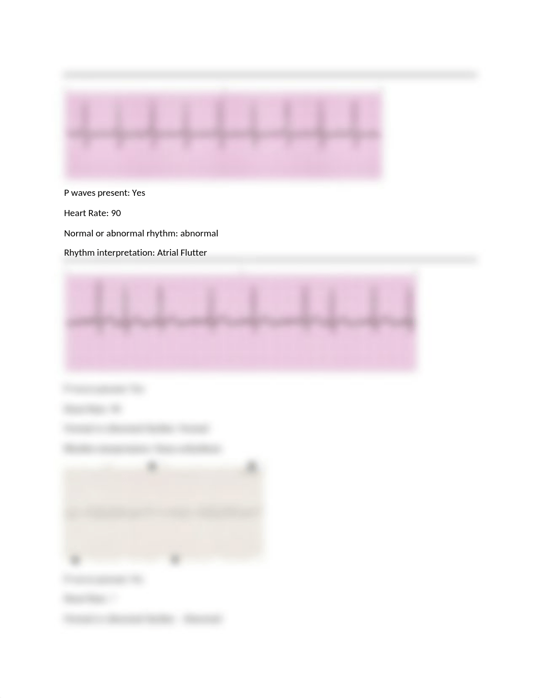 EKG Packet 2021 Milosevich.docx_d2onl212ee6_page2